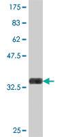 Anti-TPD52 Mouse Polyclonal Antibody