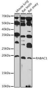 Western blot analysis of extracts of various cell lines, using Anti-PRA1 Antibody (A306813) at 1:1000 dilution. The secondary Antibody was Goat Anti-Rabbit IgG H&L Antibody (HRP) at 1:10000 dilution. Lysates/proteins were present at 25 µg per lane