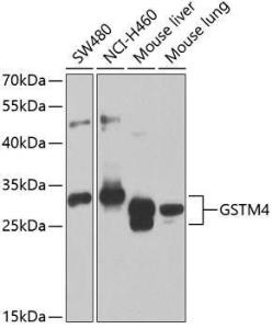 Western blot analysis of extracts of various cell lines, using Anti-GSTM4 Antibody (A12117) at 1:1,000 dilution