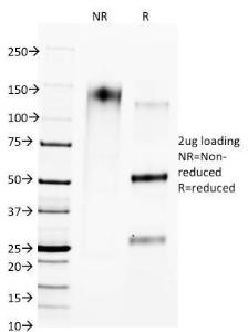 Antibody anti-CTLA4 L4P2F5F10 100 µg