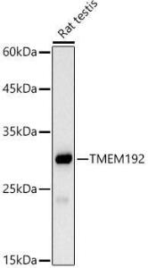 Western blot analysis of extracts of Rat testis, using Anti-TMEM192 Antibody [ARC2978] (A309496) at 1:1,000 dilution. The secondary antibody was Goat Anti-Rabbit IgG H&L Antibody (HRP) at 1:10,000 dilution.