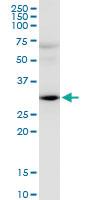 Anti-HEY2 Mouse Monoclonal Antibody [clone: 2B10]