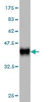 Anti-UCKL1 Mouse Monoclonal Antibody [clone: 8D4]