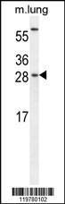 Anti-CEBPG Rabbit Polyclonal Antibody