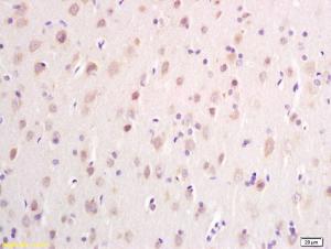 Anti-DTNB Rabbit Polyclonal Antibody