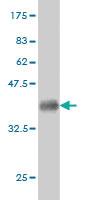 Anti-RIOK3 Mouse Monoclonal Antibody [clone: 3G11]