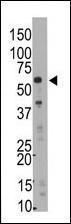 Anti-SMYD5 Rabbit Polyclonal Antibody (Biotin)