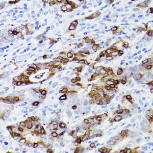 Anti-Trefoil Factor 3 Rabbit Monoclonal Antibody [clone: ARC2664]