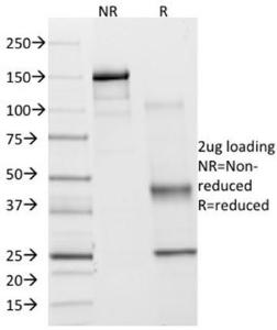 Immunohistochemical analysis of formalin-fixed, paraffin-embedded human endometrium tissue using Anti-COX2 Antibody [COX2/2377]