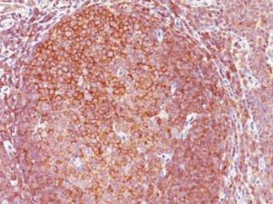 Anti-BCL10 Mouse Monoclonal Antibody [clone: BL10/411]