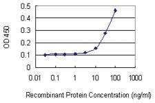 Anti-HEY2 Mouse Monoclonal Antibody [clone: 2B10]