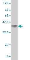 Anti-DVL3 Mouse Monoclonal Antibody [clone: 4H2]