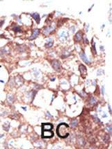 Anti-UBQLN1 Rabbit Polyclonal Antibody (Biotin)