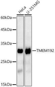 Western blot analysis of extracts of various cell lines, using Anti-TMEM192 Antibody [ARC2978] (A309496) at 1:1,000 dilution. The secondary antibody was Goat Anti-Rabbit IgG H&L Antibody (HRP) at 1:10,000 dilution.