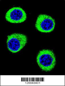 Anti-CPSF3L Rabbit Polyclonal Antibody (HRP (Horseradish Peroxidase))