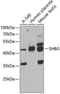 Western blot analysis of extracts of various cell lines, using Anti-SHBG Antibody (A12120) at 1:1,000 dilution