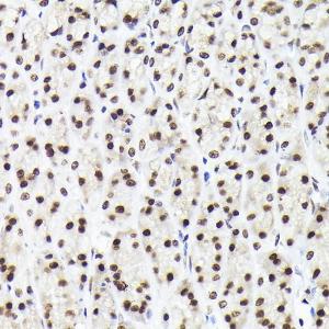 Immunohistochemistry analysis of paraffin-embedded rat stomach using Anti-Rad21 Antibody (A305614) at a dilution of 1:200 (40x lens). Perform high pressure antigen retrieval with 10 mM citrate buffer pH 6.0 before commencing with IHC staining protocol