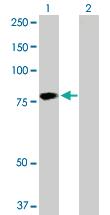 Anti-HABP2 Rabbit Polyclonal Antibody