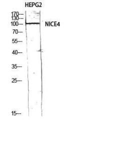 Western blot analysis of HEPG2 using Anti-UBAP2L Antibody