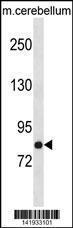 Anti-NSF Rabbit Polyclonal Antibody (FITC (Fluorescein Isothiocyanate))