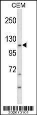 Anti-KIT Mouse Monoclonal Antibody [clone: 566CT8.5.4]