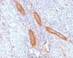 SDS-PAGE analysis of Anti-COX2 Antibody [COX2/2377] under non-reduced and reduced conditions; showing intact IgG and intact heavy and light chains, respectively. SDS-PAGE analysis confirms the integrity and purity of the antibody.