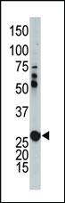 Anti-AK2 Rabbit Polyclonal Antibody