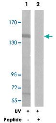 Anti-SMC1A Rabbit Polyclonal Antibody