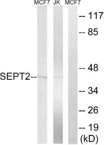 Western blot analysis of lysates from Jurkat and MCF-7 cells using Anti-SEPT2 Antibody. The right hand lane represents a negative control, where the antibody is blocked by the immunising peptide