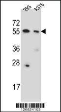 Anti-CPNE8 Rabbit Polyclonal Antibody