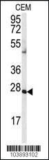 Anti-AK2 Rabbit Polyclonal Antibody