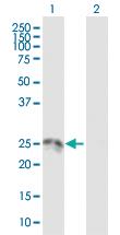 Anti-HSD17B10 Mouse Polyclonal Antibody