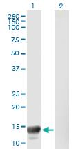 Anti-MACF1 Mouse Monoclonal Antibody [clone: 1G9]