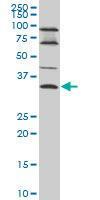 Anti-EPSTI1 Mouse Monoclonal Antibody [clone: 2A8]