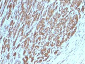 Anti-beta Catenin Mouse Monoclonal Antibody [clone: CTNNB1/2098]