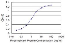 Anti-MACF1 Mouse Monoclonal Antibody [clone: 1G9]