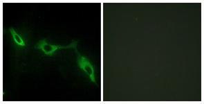 Anti-Galectin-9 Rabbit polyclonal antibody