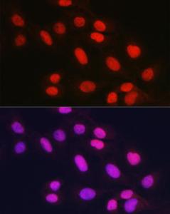 Immunofluorescence analysis of U2OS cells using Anti-Rad21 Antibody (A305614) at a dilution of 1:100 (40x lens). DAPI was used to stain the cell nuclei (blue)