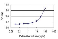 Anti-IL22RA1 Polyclonal Antibody Pair