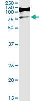 Anti-RIOK3 Antibody Pair