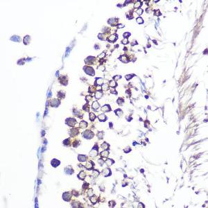 Immunohistochemistry analysis of paraffin-embedded rat testis using Anti-JAB1 Antibody [ARC0895] (A306818) at a dilution of 1:100 (40x lens). Perform microwave antigen retrieval with 10 mM PBS buffer pH 7.2 before commencing with IHC staining protocol.