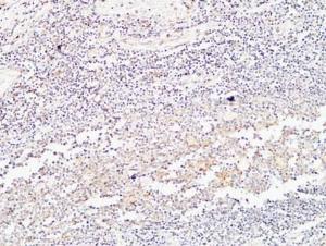 Immunohistochemical analysis of paraffin-embedded human Amygdala using Anti-BMP15 Antibody