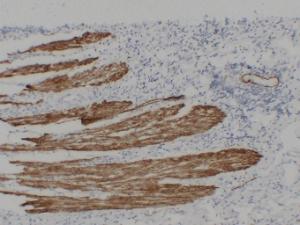 Immunohistochemical analysis of paraffin-embedded human Colon using Anti-Desmin Antibody