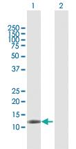 Anti-DAAM2 Rabbit Polyclonal Antibody