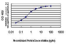 Anti-EPSTI1 Mouse Monoclonal Antibody [clone: 2A8]