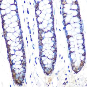 Immunohistochemistry analysis of paraffin-embedded human colon tissue using Anti-JAB1 Antibody [ARC0895] (A306818) at a dilution of 1:100 (40x lens). Perform microwave antigen retrieval with 10 mM PBS buffer pH 7.2 before commencing with IHC staining protocol.