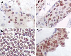 Anti-MAPKAPK5 Mouse Monoclonal Antibody [clone: 7H10B4]