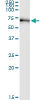 Anti-RIOK3 Polyclonal Antibody Pair