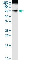 Anti-DVL3 Polyclonal Antibody Pair