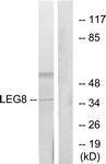 Anti-Galectin-8 Rabbit polyclonal antibody